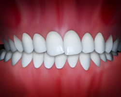Perfect smile showing aligned white teeth in ideal occlusion against pink gum background.