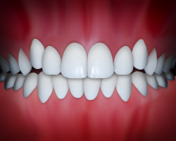 Perfectly aligned white teeth displayed in ideal dental occlusion against pink gum background.