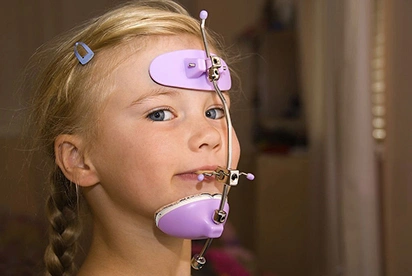 Young girl wearing purple orthodontic braces and headgear during dental treatment.