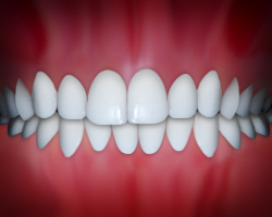 Perfectly aligned white teeth in correct bite position against pink gum background