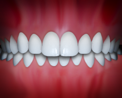 Perfectly aligned white teeth in ideal bite position against pink gum background.