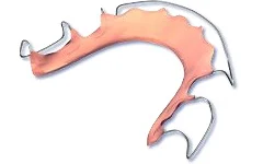 Curved orthodontic wire or bracket illustration in coral and gray tones for dental treatment.