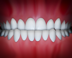 Perfectly aligned white teeth displayed in direct frontal view against red gum background.