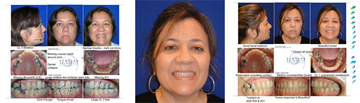 Patient smile transformation showing before and after orthodontic treatment results at Statler Orthodontics.