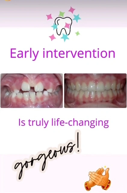Before and after orthodontic treatment showing dental alignment improvement with "Early intervention is truly life-changing" message.